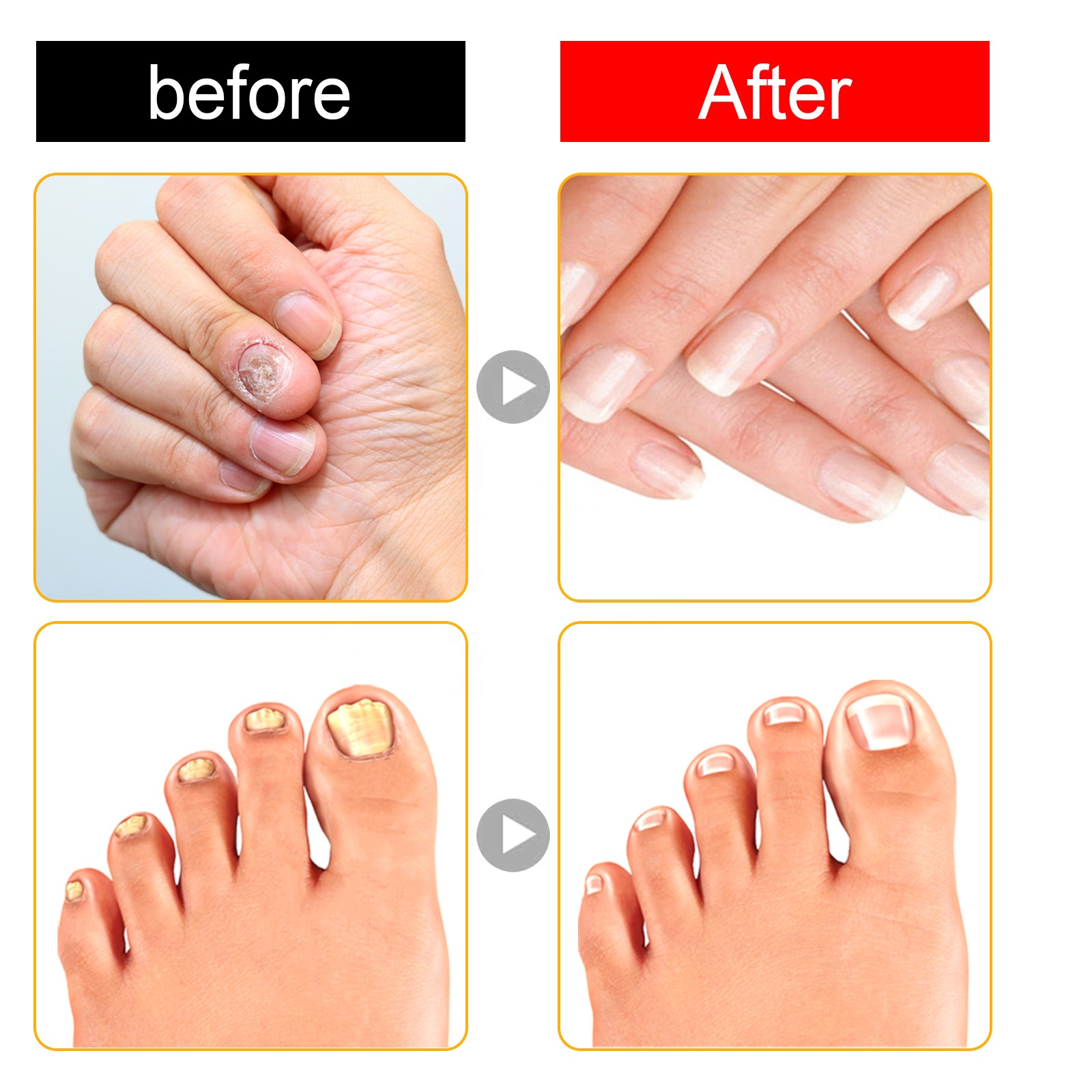 Pâte réparatrice pour les ongles – Soin des ongles 20 g – Image 4
