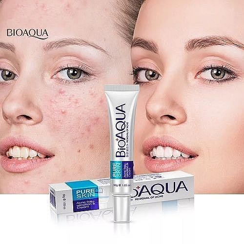 creme bioaqua anti acné