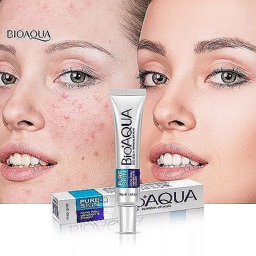 creme bioaqua anti acné