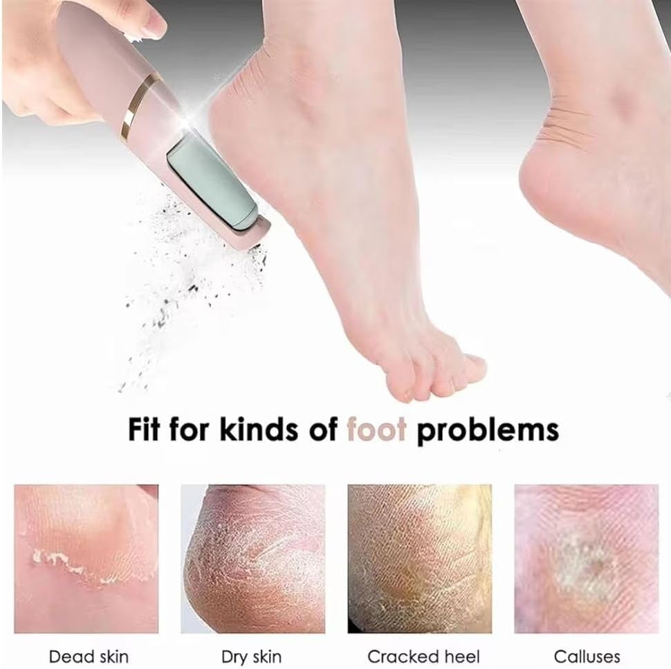 Râpe à Pieds Électrique Rechargeable Anti-Callosités & Pédicure Pro